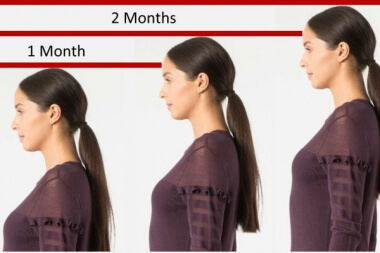 Height Growth Medicine In Subhash Nagar